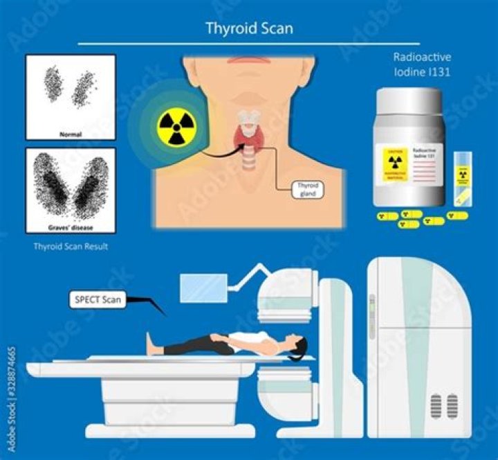 Are radiation precautions needed for thyroid scan?