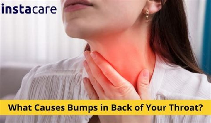 Are red bumps on back of throat normal?