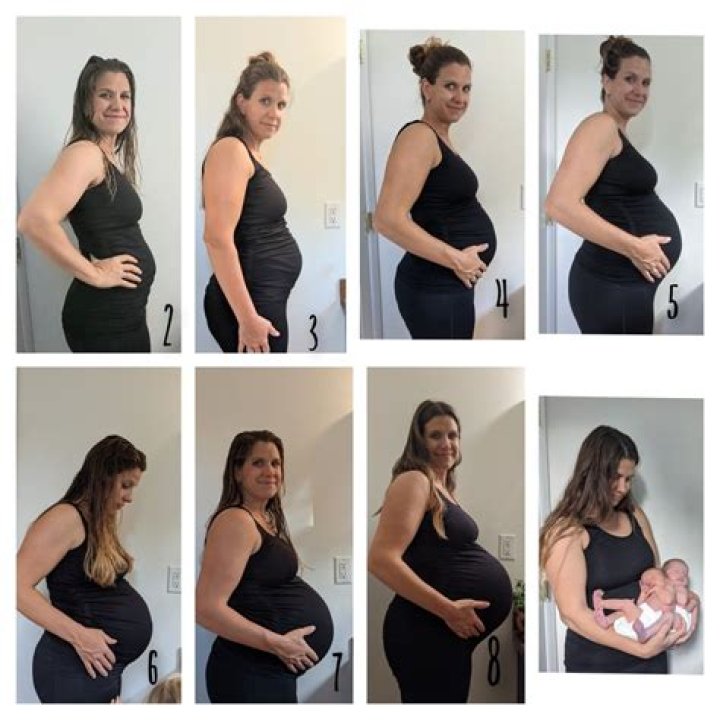 Can a baby bump appear and disappear?