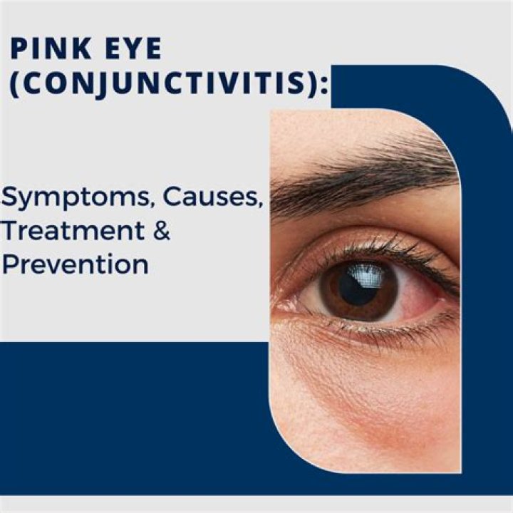 Can I use eye drops if I have pink eye?