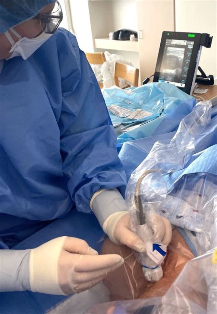 Can nurse remove tunneled catheter?