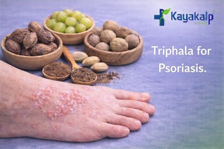 Can psoriasis be cured permanently by Ayurveda?