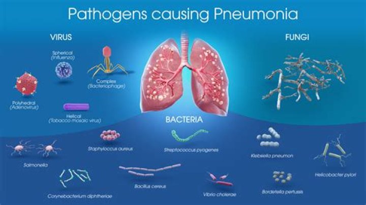 Can sepsis cause pneumonia?