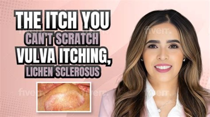 Can you have lichen sclerosus in the vagina?