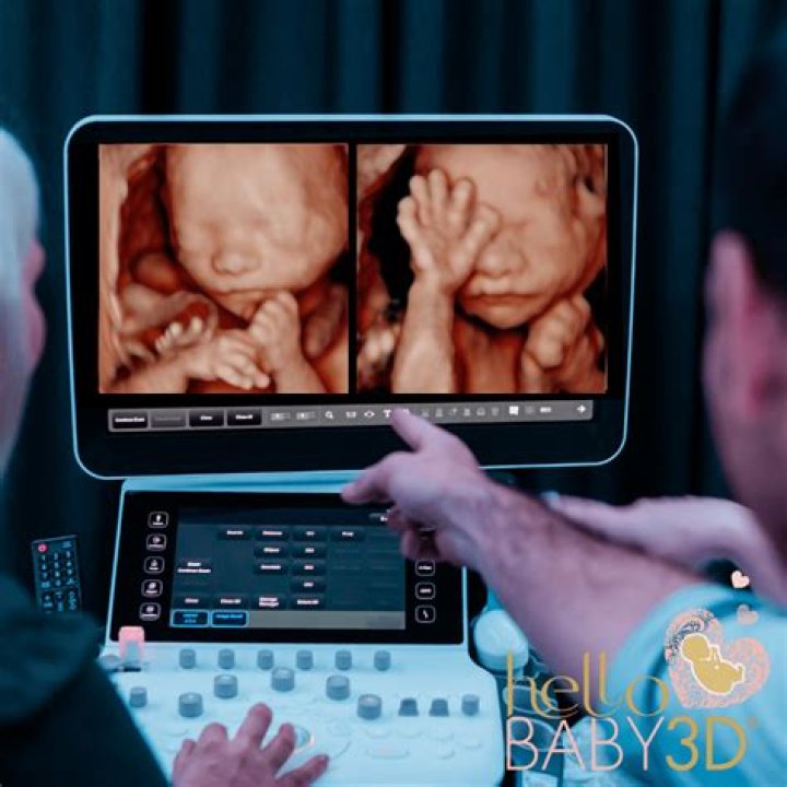 Can you see birth defects on a 3D ultrasound?
