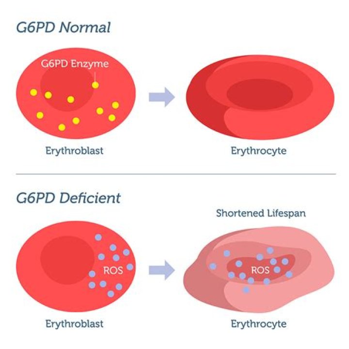Do amputees have a shorter lifespan?