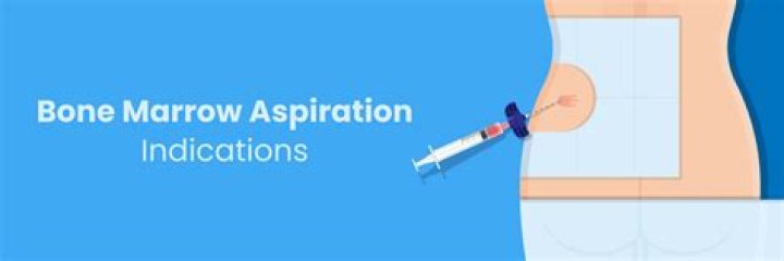 Do you need informed consent for bone marrow aspiration?