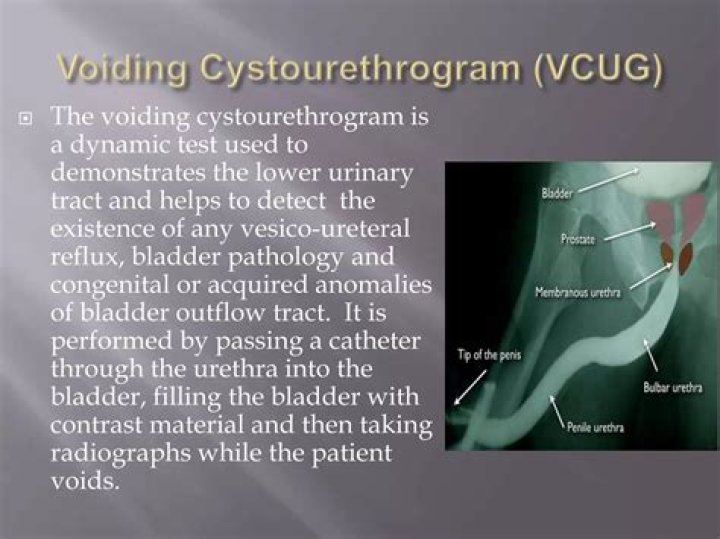 Does a voiding Cystourethrogram use contrast?