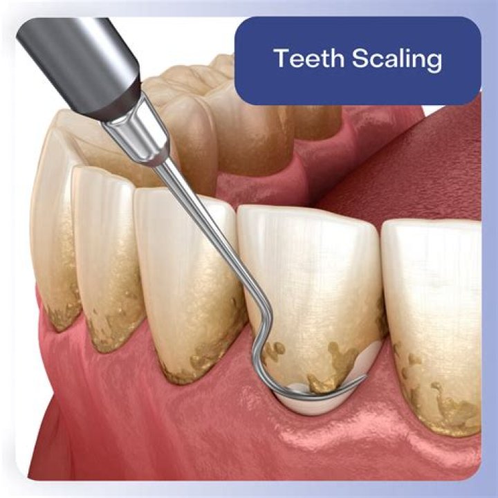 Does gum clean teeth?