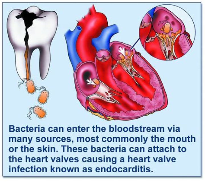 Does Vectra 3D enter the bloodstream?