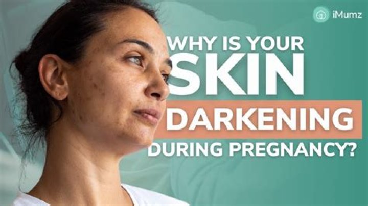 How can I get rid of my dark neck during pregnancy?