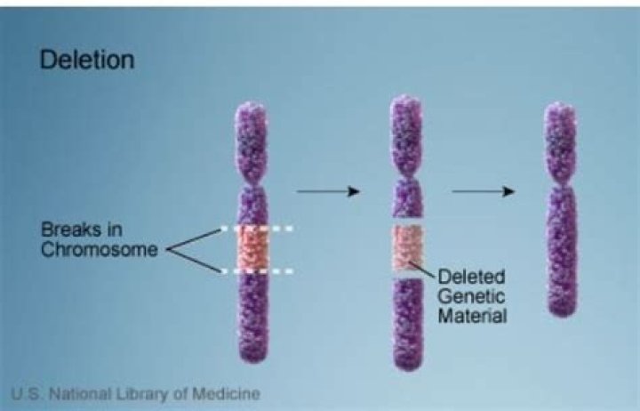 How common is 17p deletion in CLL?