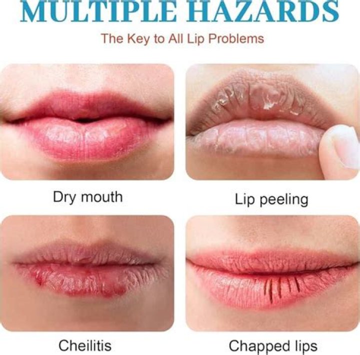 How do I get my lips to stop being chapped without chapstick?