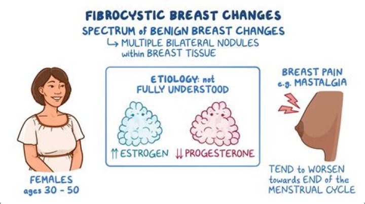 How do they fix breast hypoplasia?