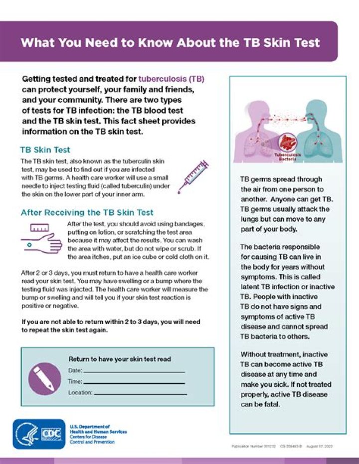 How do you get a TB test in Ontario?
