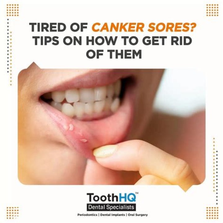 How do you get rid of sores above your lip?