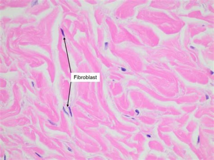 How do you identify fibroblasts?
