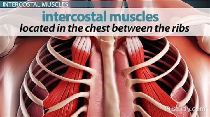 How do you know if you have pulled an intercostal muscle?