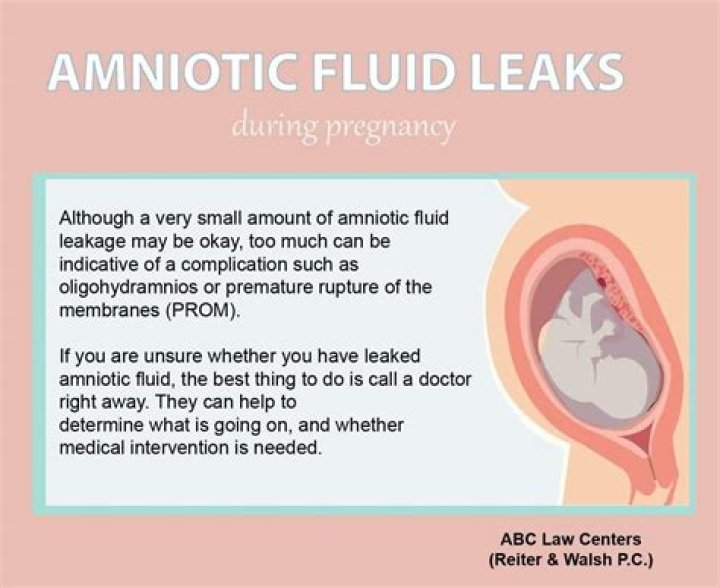 How do you know if your leaking amniotic fluid at 28 weeks?
