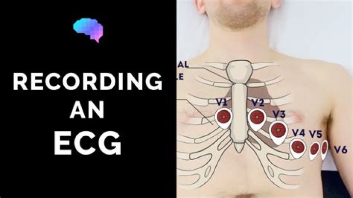 How do you perform an ECG on a female?