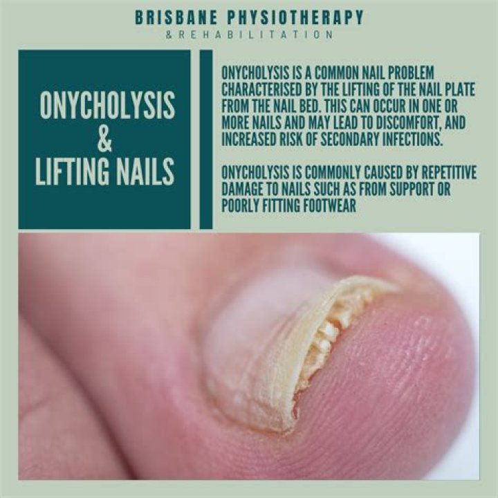 How do you treat Trachyonychia?