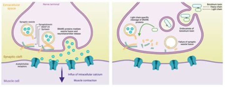 How does botulinum toxin affect the synapse?