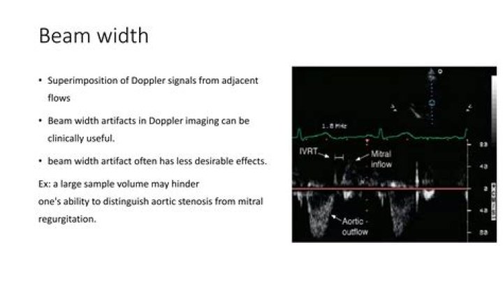 How is beam width measured in ultrasound?