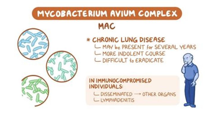 How is Mycobacterium Marinum diagnosed?