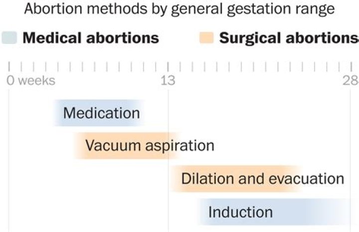 How long after an abortion can you get septic shock?