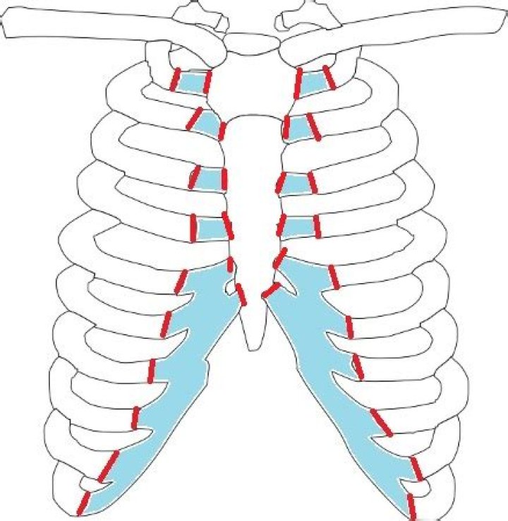 How long does Costochondral separation take to heal
