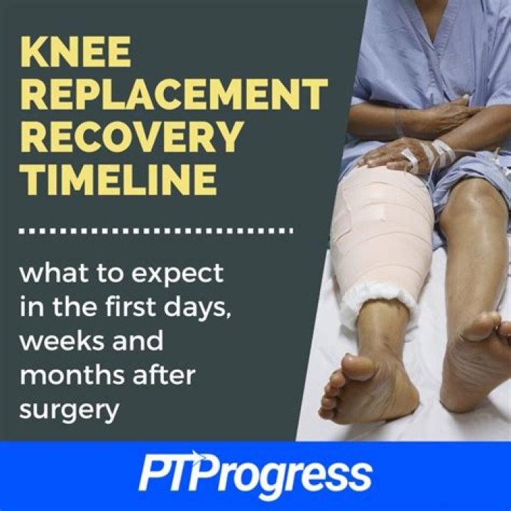 How long does it take to recover from a femoral osteotomy?
