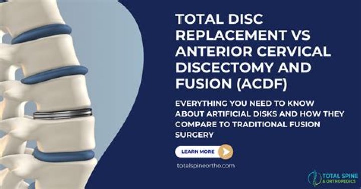 How long does it take to recover from anterior cervical discectomy?
