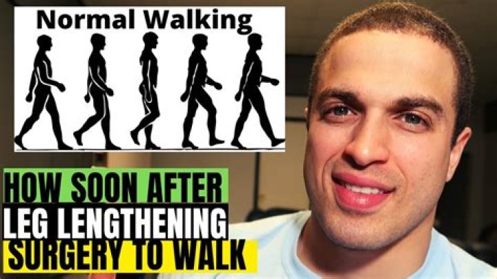 How long does it take to walk after limb lengthening surgery?