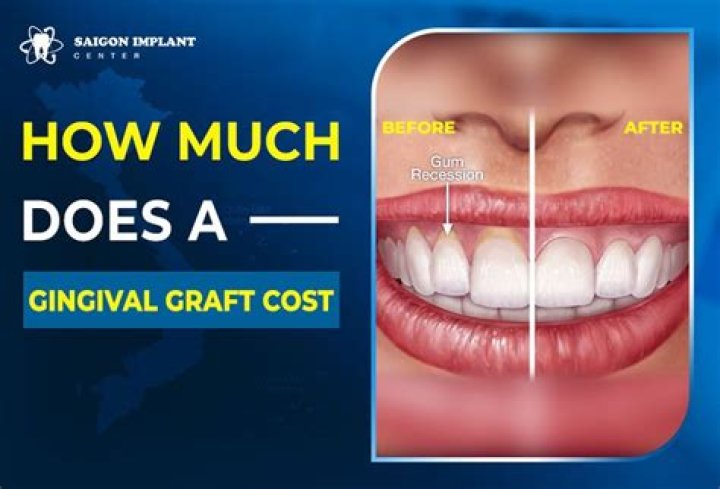 How much does a gum cost?