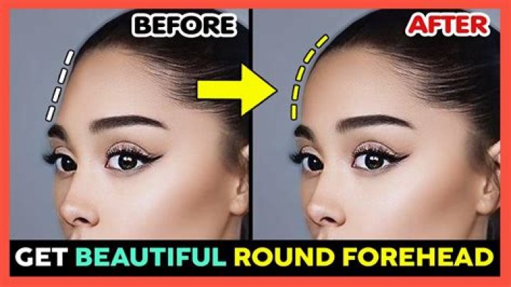 Is a bigger forehead more attractive?