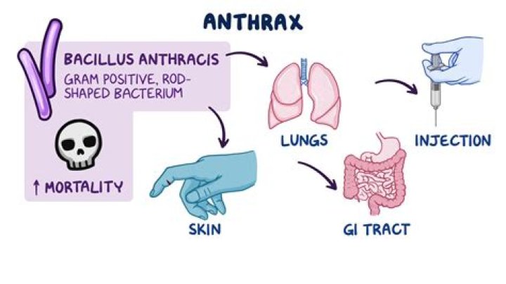 Is anthrax viral or bacterial?