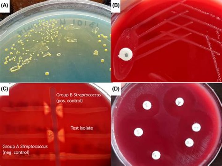 Is Streptococcus mutans catalase positive?