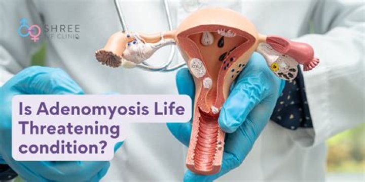 Is there any homeopathic treatment for adenomyosis uterus