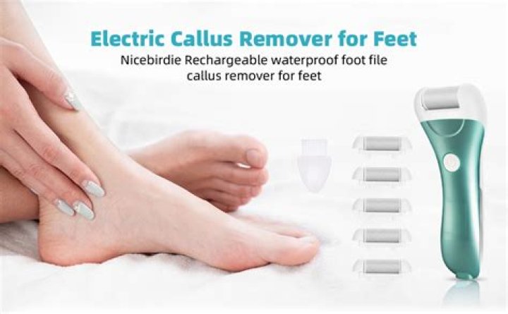 Should diabetics remove calluses?