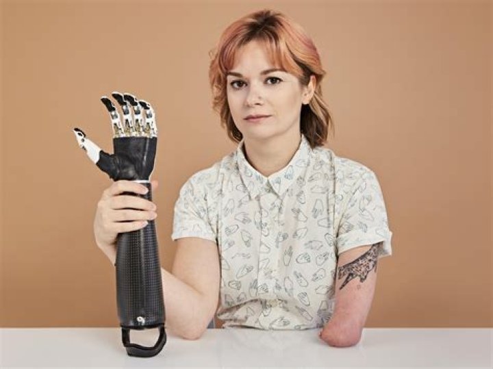 What actresses have prosthetic legs?