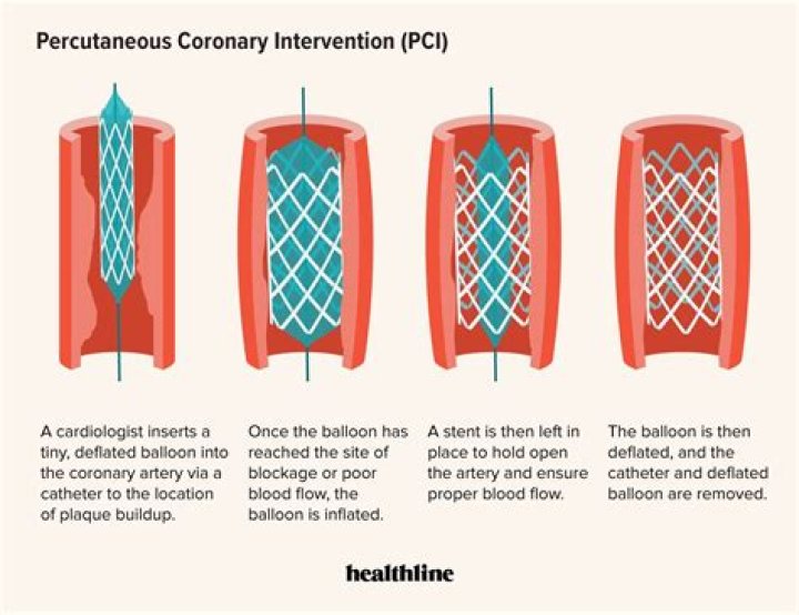 What are complications of percutaneous coronary intervention?