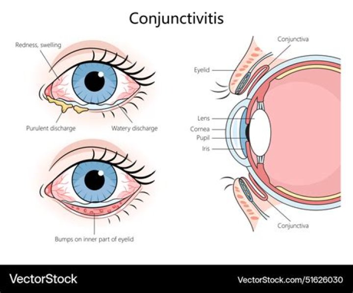 What are conjunctival Fornices?