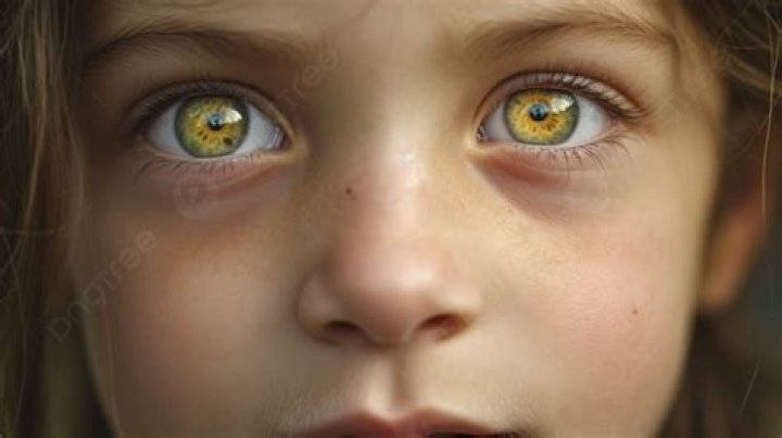 What are yellow colored eyes called?