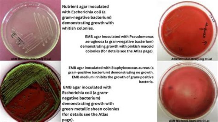 What bacteria grows on EMB?