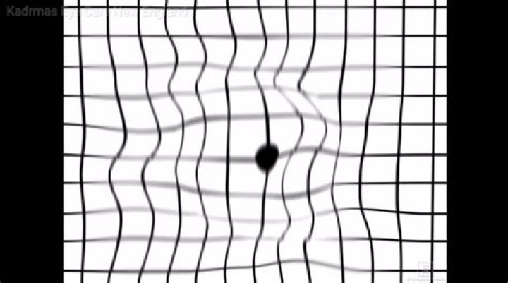 What causes eyes to see wavy lines?