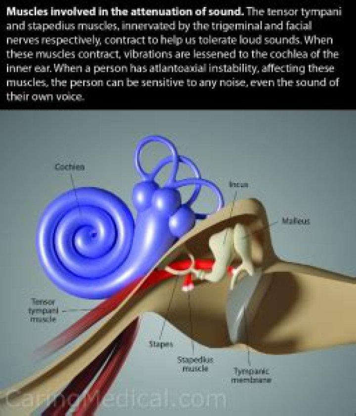 What causes the tensor tympani muscle to spasm?
