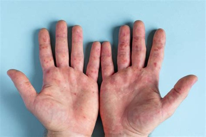 What diseases affect the hands?