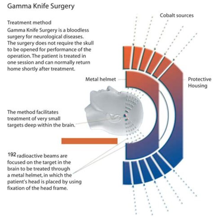 What does Gamma Knife treat?