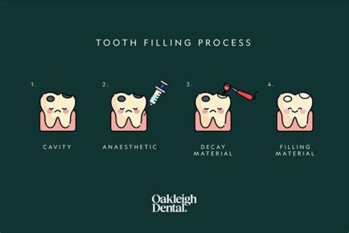 What does it mean for filling to be set?
