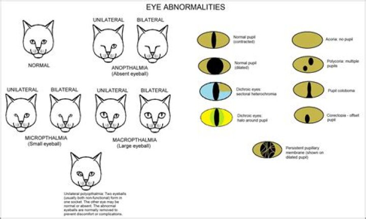 What does it mean if you have stream eyes?